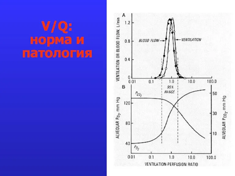 V/Q: норма и патология