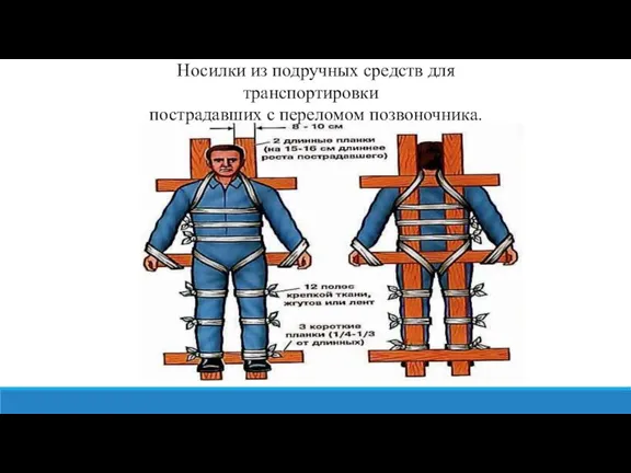 Носилки из подручных средств для транспортировки пострадавших с переломом позвоночника.