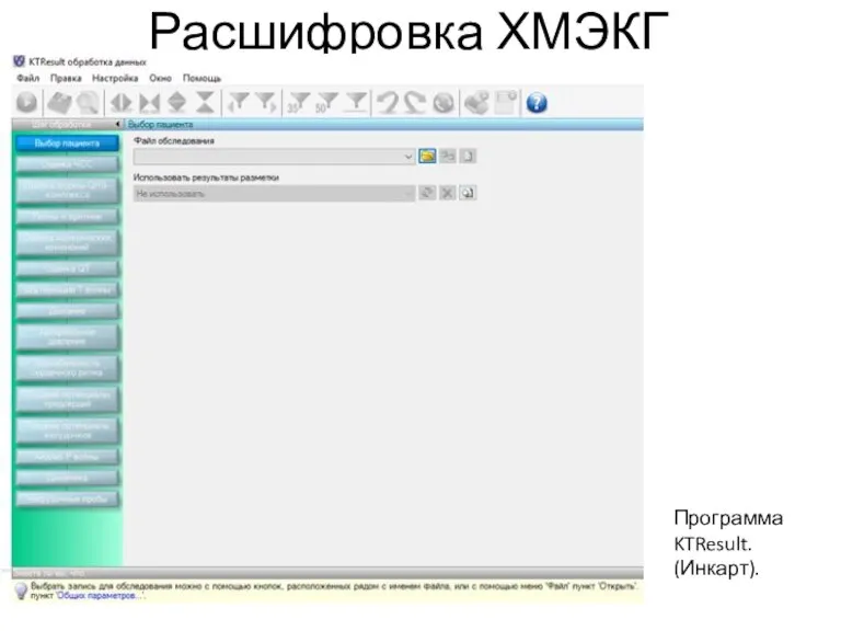 Расшифровка ХМЭКГ Программа KTResult. (Инкарт).