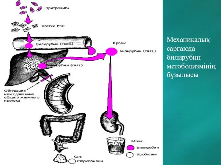 Механикалық сарғаюда билирубин метоболизмінің бұзылысы
