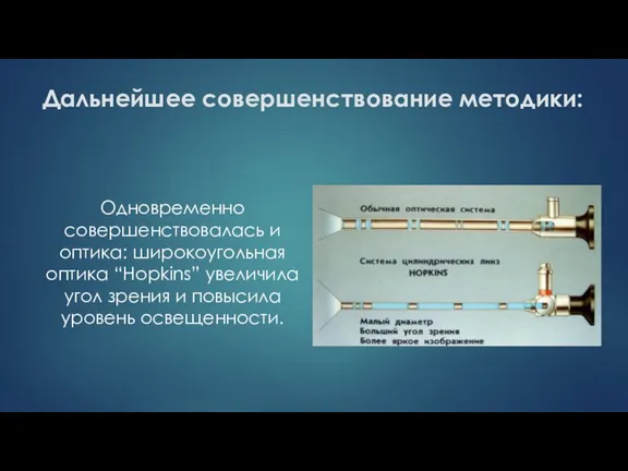 Дальнейшее совершенствование методики: Одновременно совершенствовалась и оптика: широкоугольная оптика “Hopkins” увеличила угол