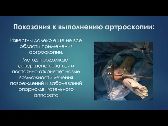 Показания к выполнению артроскопии: Известны далеко еще не все области применения артроскопии.