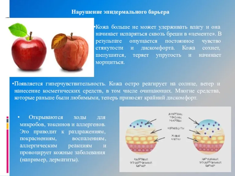 Нарушение эпидермального барьера Кожа больше не может удерживать влагу и она начинает