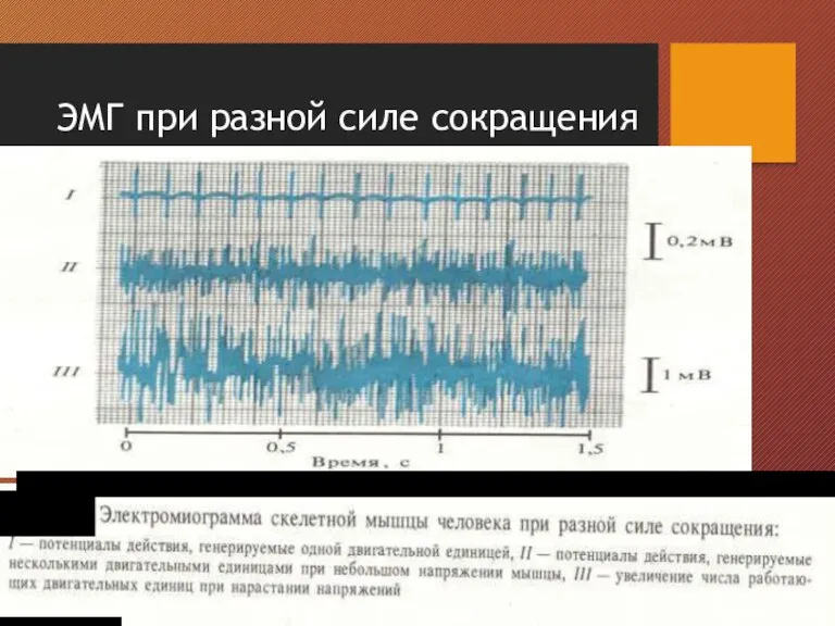 ЭМГ при разной силе сокращения