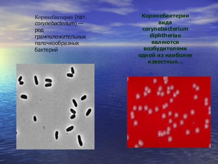 Коринебактерии вида corynebacterium diphtheriae являются возбудителями одной из наиболее известных... Коринебактерии (лат.