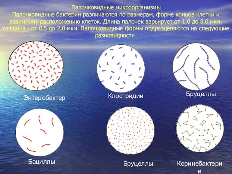 Палочковидные микроорганизмы Палочковидные бактерии различаются по размерам, форме концов клетки и взаимному