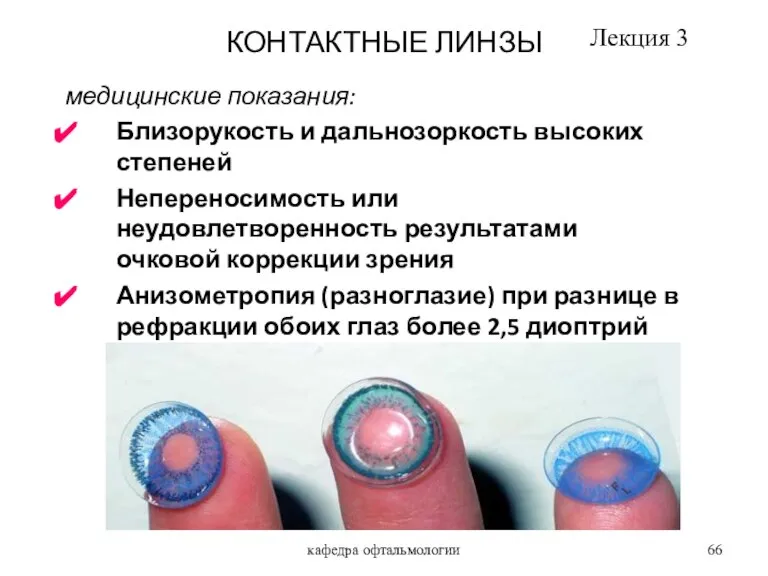 кафедра офтальмологии КОНТАКТНЫЕ ЛИНЗЫ медицинские показания: Близорукость и дальнозоркость высоких степеней Непереносимость