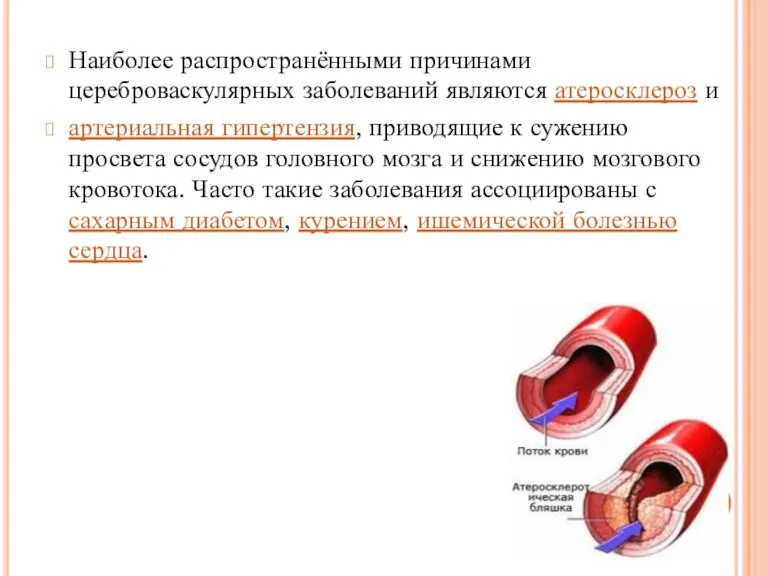 Наиболее распространёнными причинами цереброваскулярных заболеваний являются атеросклероз и артериальная гипертензия, приводящие к