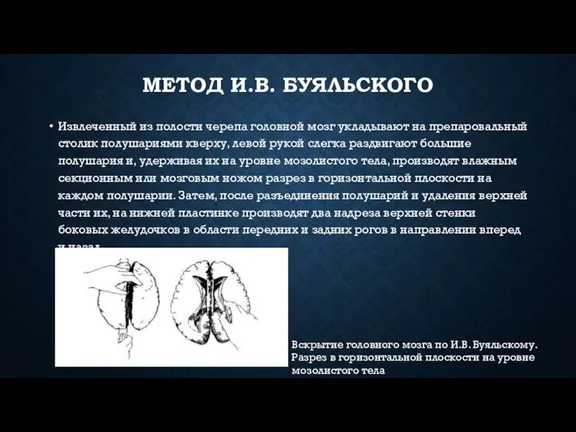 МЕТОД И.В. БУЯЛЬСКОГО Извлеченный из полости черепа головной мозг укладывают на препаровальный