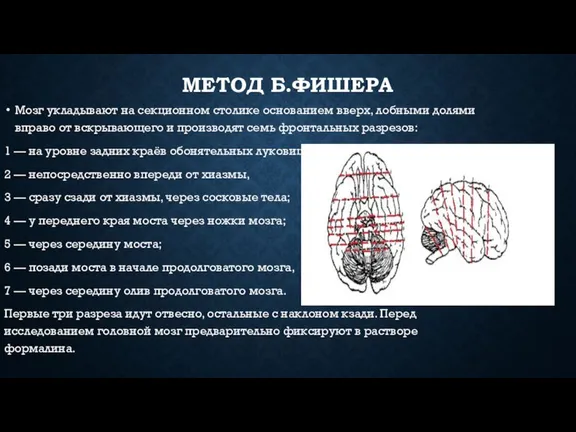 МЕТОД Б.ФИШЕРА Мозг укладывают на секционном столике основанием вверх, лобными долями вправо