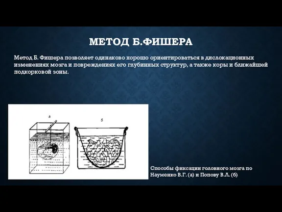 МЕТОД Б.ФИШЕРА Способы фиксации головного мозга по Науменко В.Г. (а) и Попо­ву