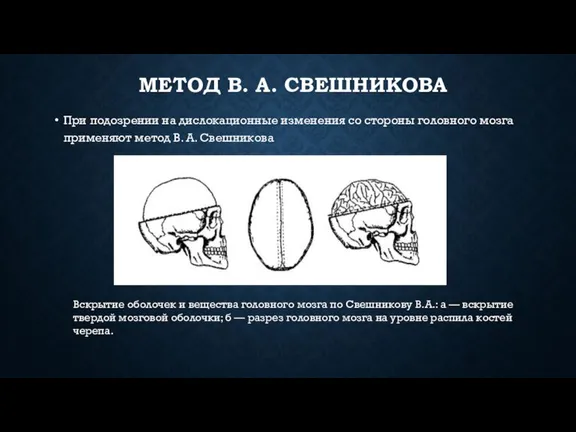 МЕТОД В. А. СВЕШНИКОВА При подозрении на дислокационные изменения со стороны головного