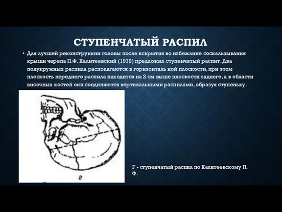 Г - сту­пенчатый распил по Калитеевскому П.Ф. СТУПЕНЧАТЫЙ РАСПИЛ Для лучшей реконструкиии