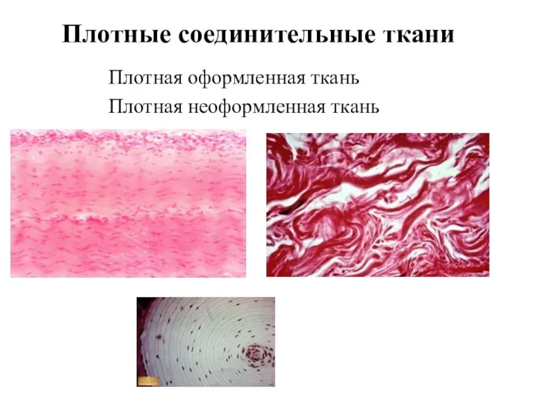 Плотные соединительные ткани Плотная оформленная ткань Плотная неоформленная ткань