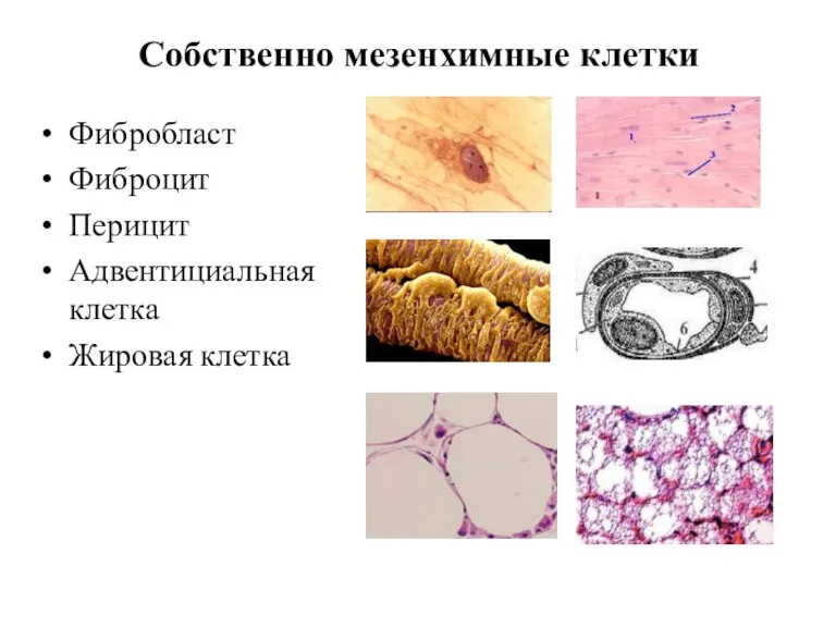 Собственно мезенхимные клетки Фибробласт Фиброцит Перицит Адвентициальная клетка Жировая клетка