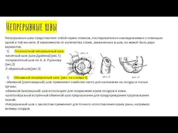 Непрерывные швы Непрерывные швы представляют собой серию стежков, последовательно накладываемых с помощью