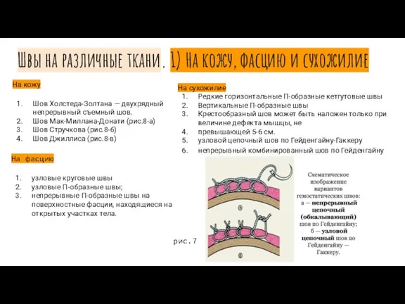 Швы на различные ткани. 1) На кожу, фасцию и сухожилие На кожу