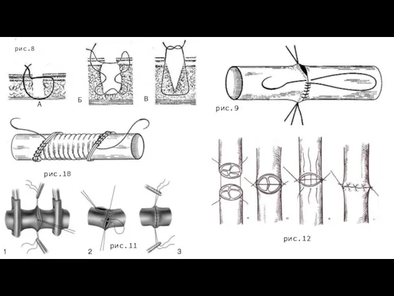 рис.8 А Б В рис.9 рис.10 рис.11 рис.12