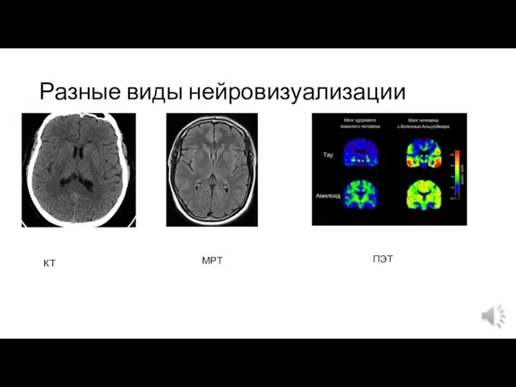 Разные виды нейровизуализации КТ МРТ ПЭТ