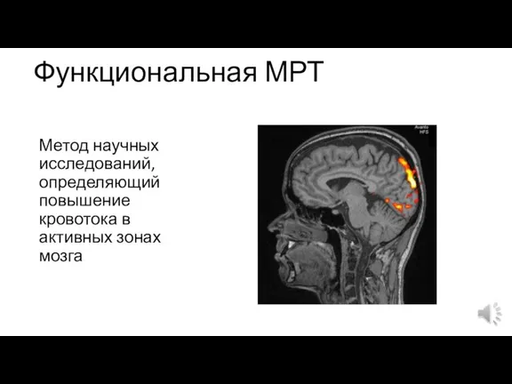 Функциональная МРТ Метод научных исследований, определяющий повышение кровотока в активных зонах мозга
