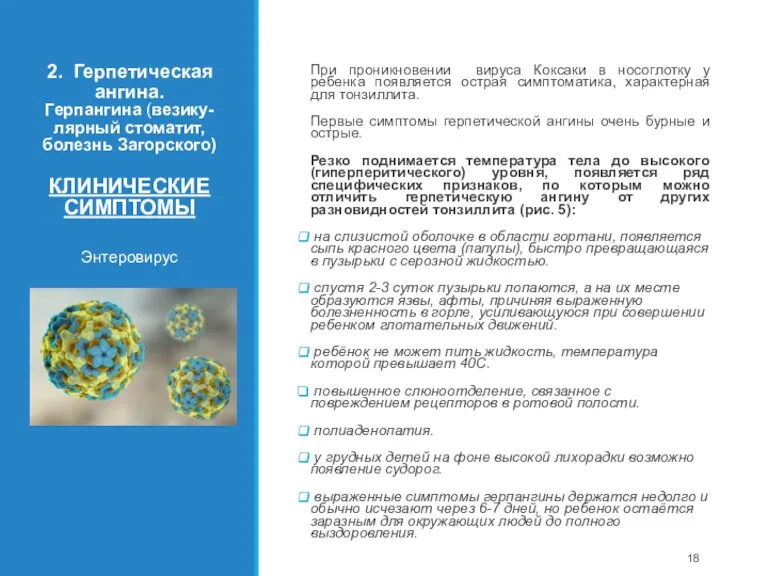 2. Герпетическая ангина. Герпангина (везику-лярный стоматит, болезнь Загорского) КЛИНИЧЕСКИЕ СИМПТОМЫ Энтеровирус РУКА