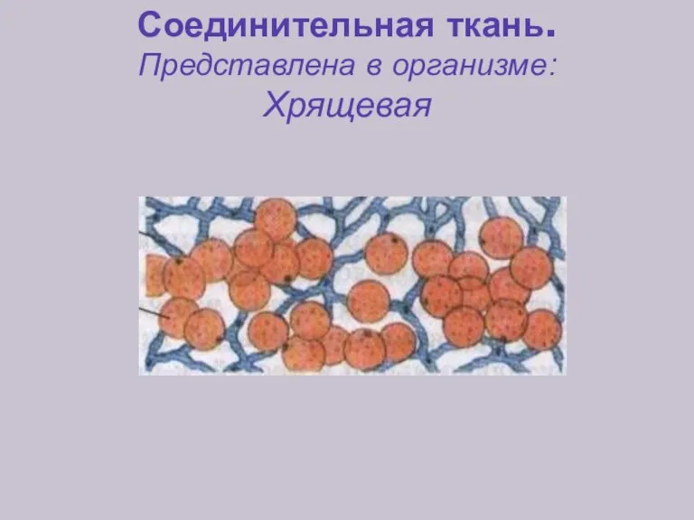 Соединительная ткань. Представлена в организме: Хрящевая