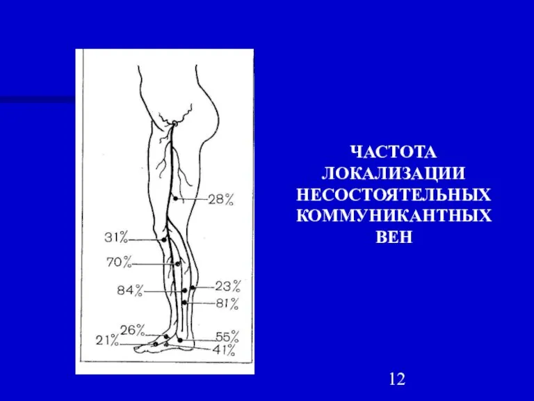 ЧАСТОТА ЛОКАЛИЗАЦИИ НЕСОСТОЯТЕЛЬНЫХ КОММУНИКАНТНЫХ ВЕН