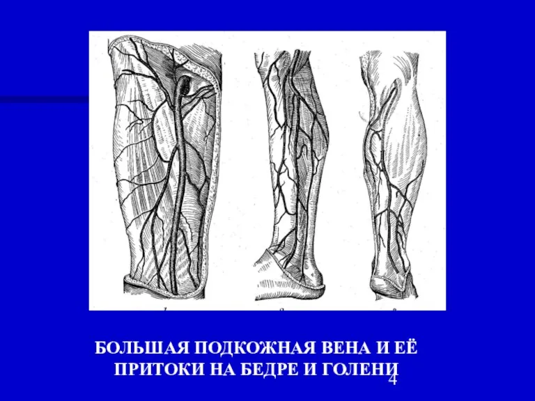 БОЛЬШАЯ ПОДКОЖНАЯ ВЕНА И ЕЁ ПРИТОКИ НА БЕДРЕ И ГОЛЕНИ