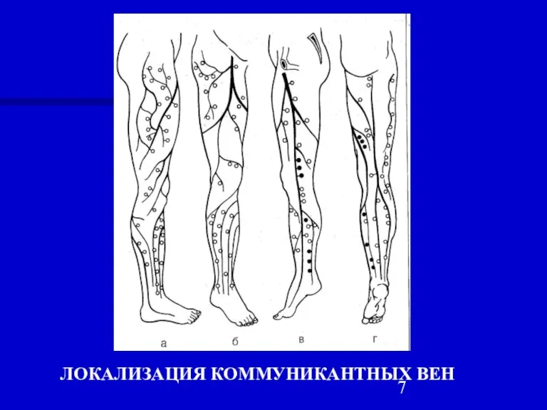 ЛОКАЛИЗАЦИЯ КОММУНИКАНТНЫХ ВЕН