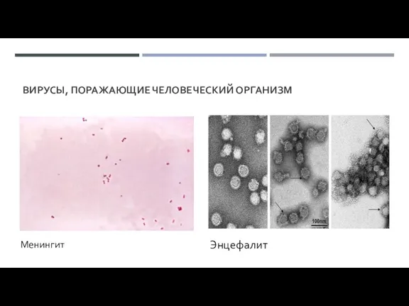 ВИРУСЫ, ПОРАЖАЮЩИЕ ЧЕЛОВЕЧЕСКИЙ ОРГАНИЗМ Менингит Энцефалит