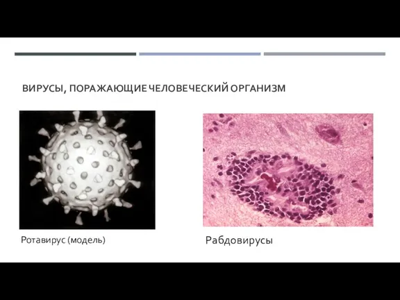 ВИРУСЫ, ПОРАЖАЮЩИЕ ЧЕЛОВЕЧЕСКИЙ ОРГАНИЗМ Ротавирус (модель) Рабдовирусы