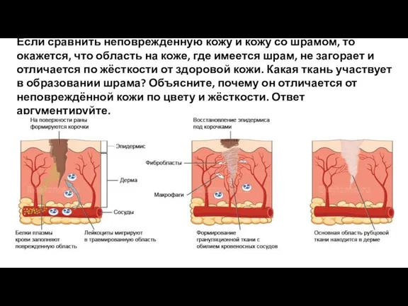 Если сравнить неповреждённую кожу и кожу со шрамом, то окажется, что область