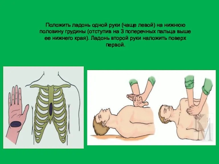 Положить ладонь одной руки (чаще левой) на нижнюю половину грудины (отступив на