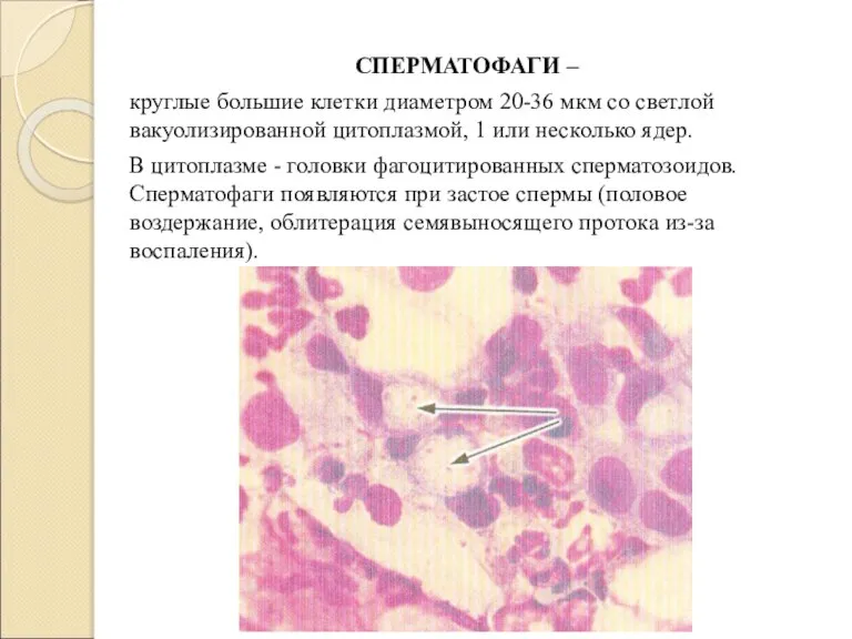СПЕРМАТОФАГИ – круглые большие клетки диаметром 20-36 мкм со светлой вакуолизированной цитоплазмой,