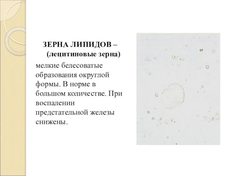 ЗЕРНА ЛИПИДОВ – (лецитиновые зерна) мелкие белесоватые образования округлой формы. В норме