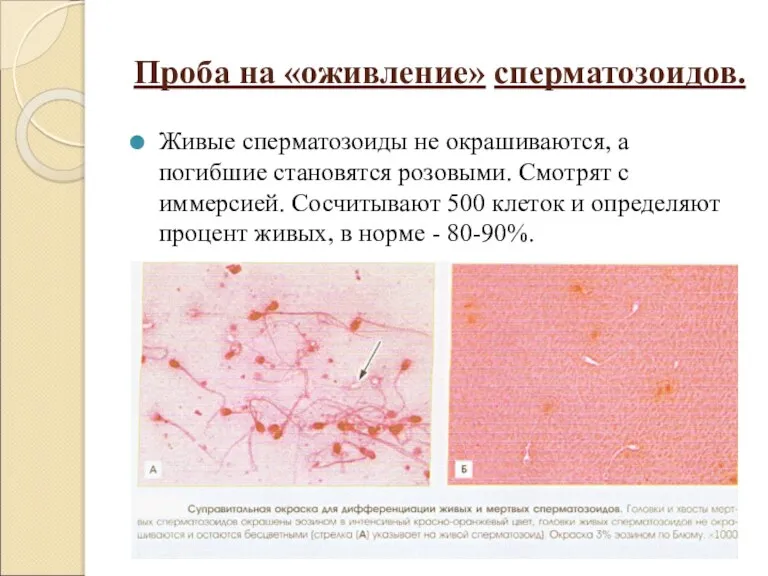 Проба на «оживление» сперматозоидов. Живые сперматозоиды не окрашиваются, а погибшие становятся розовыми.