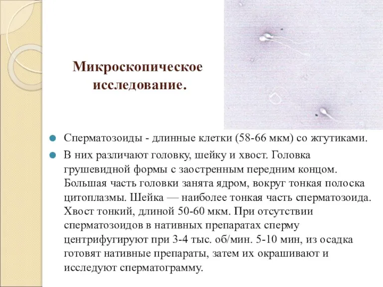 Микроскопическое исследование. Сперматозоиды - длинные клетки (58-66 мкм) со жгутиками. В них