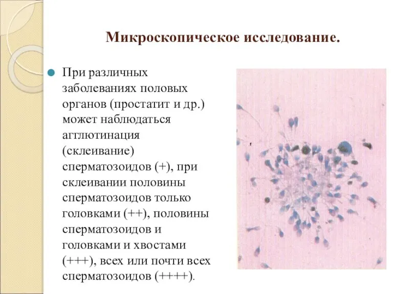 Микроскопическое исследование. При различных заболеваниях половых органов (простатит и др.) может наблюдаться