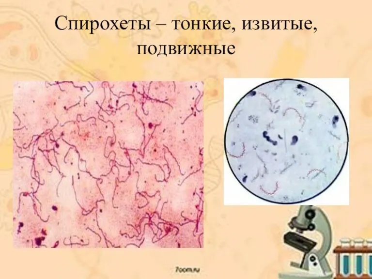 Спирохеты – тонкие, извитые, подвижные