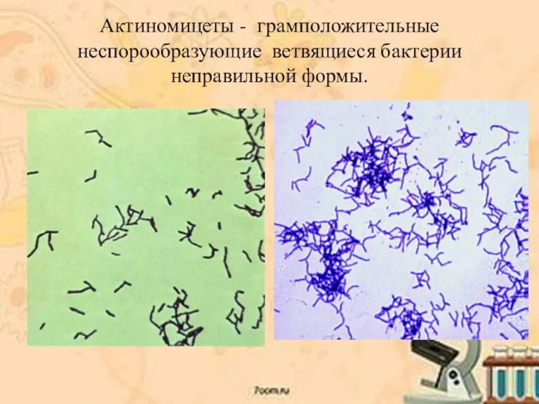 Актиномицеты - грамположительные неспорообразующие ветвящиеся бактерии неправильной формы.