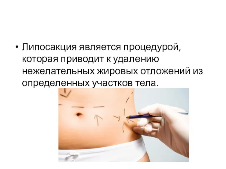 Липосакция является процедурой, которая приводит к удалению нежелательных жировых отложений из определенных участков тела.