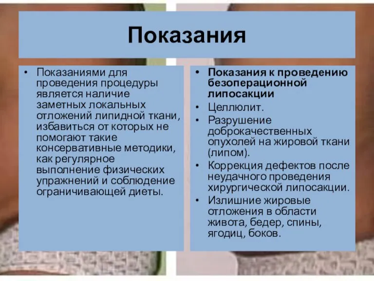 Показания Показаниями для проведения процедуры является наличие заметных локальных отложений липидной ткани,