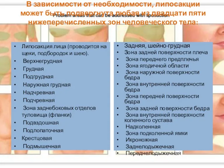 В зависимости от необходимости, липосакции может быть подвергнута любая из двадцати пяти