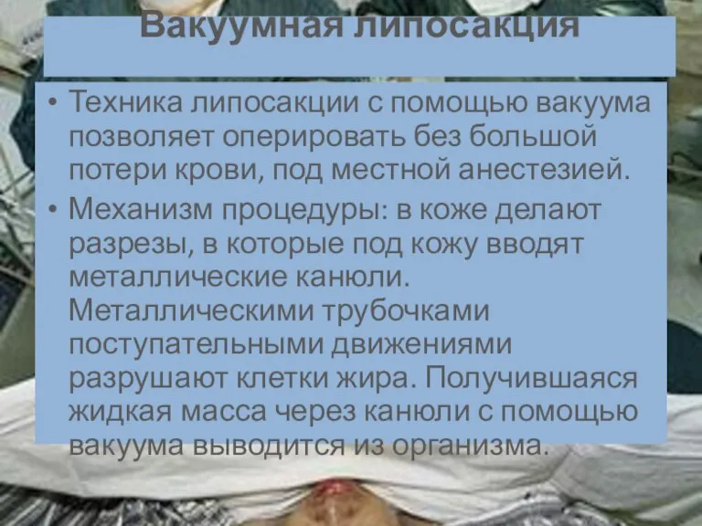 Вакуумная липосакция Техника липосакции с помощью вакуума позволяет оперировать без большой потери