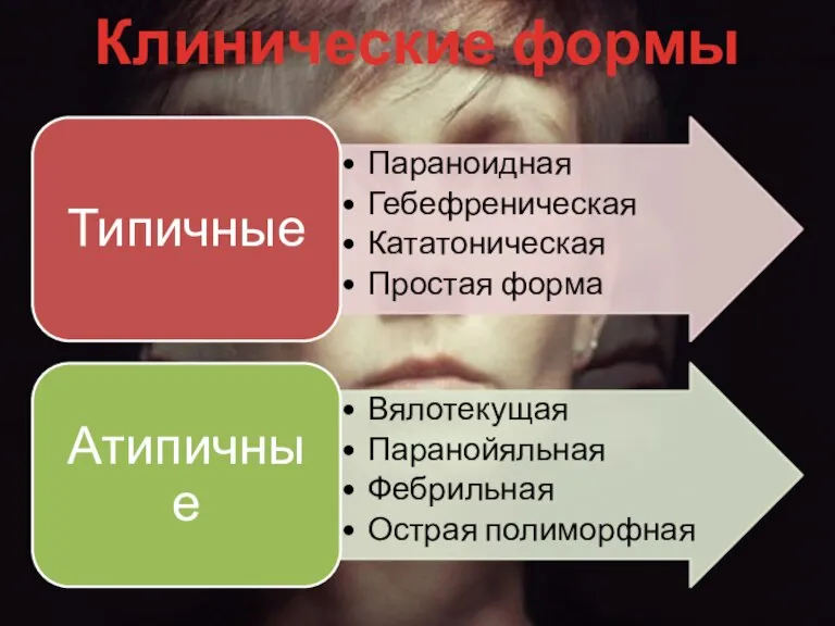 Клинические формы