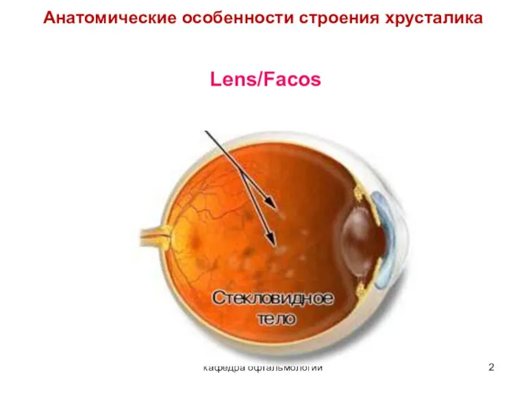 кафедра офтальмологии Анатомические особенности строения хрусталика Lens/Facos