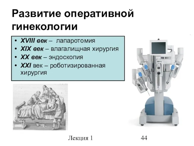 Лекция 1 Развитие оперативной гинекологии ХVIII век – лапаротомия XIX век –