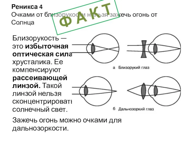 Реникса 4 Очками от близорукости нельзя зажечь огонь от Солнца Близорукость —