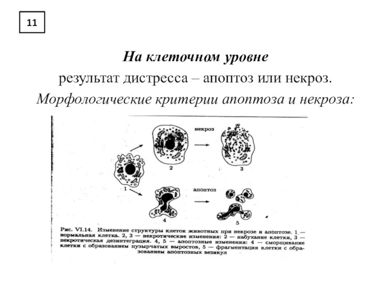 11 На клеточном уровне результат дистресса – апоптоз или некроз. Морфологические критерии апоптоза и некроза: