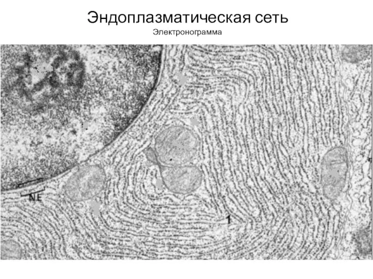 Эндоплазматическая сеть Электронограмма